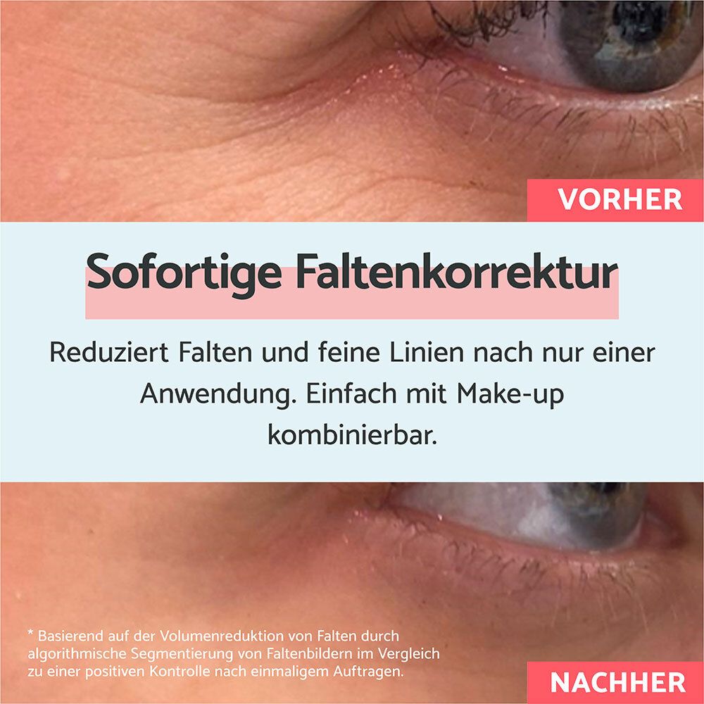 Vorher-Nachher-Vergleich der Augenpartie, der die Wirkung von Remescar Sofortige Faltenkorrektur zeigt.