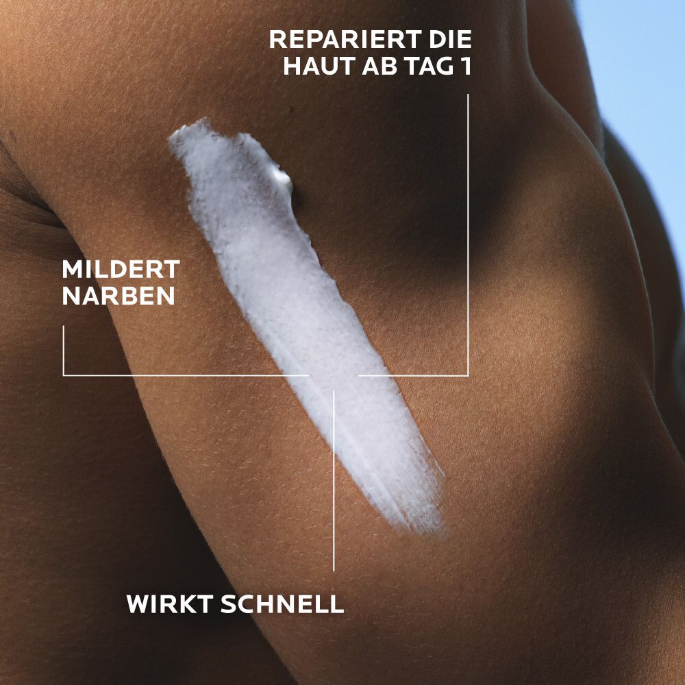 Arm mit Creme-Auftrag. Text: Repariert die Haut ab Tag 1, mildert Narben, wirkt schnell.