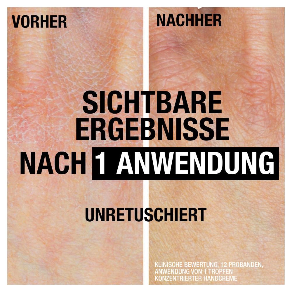 Vorher-Nachher-Vergleich von Händen. Text: Sichtbare Ergebnisse nach 1 Anwendung. Unretuschiert.
