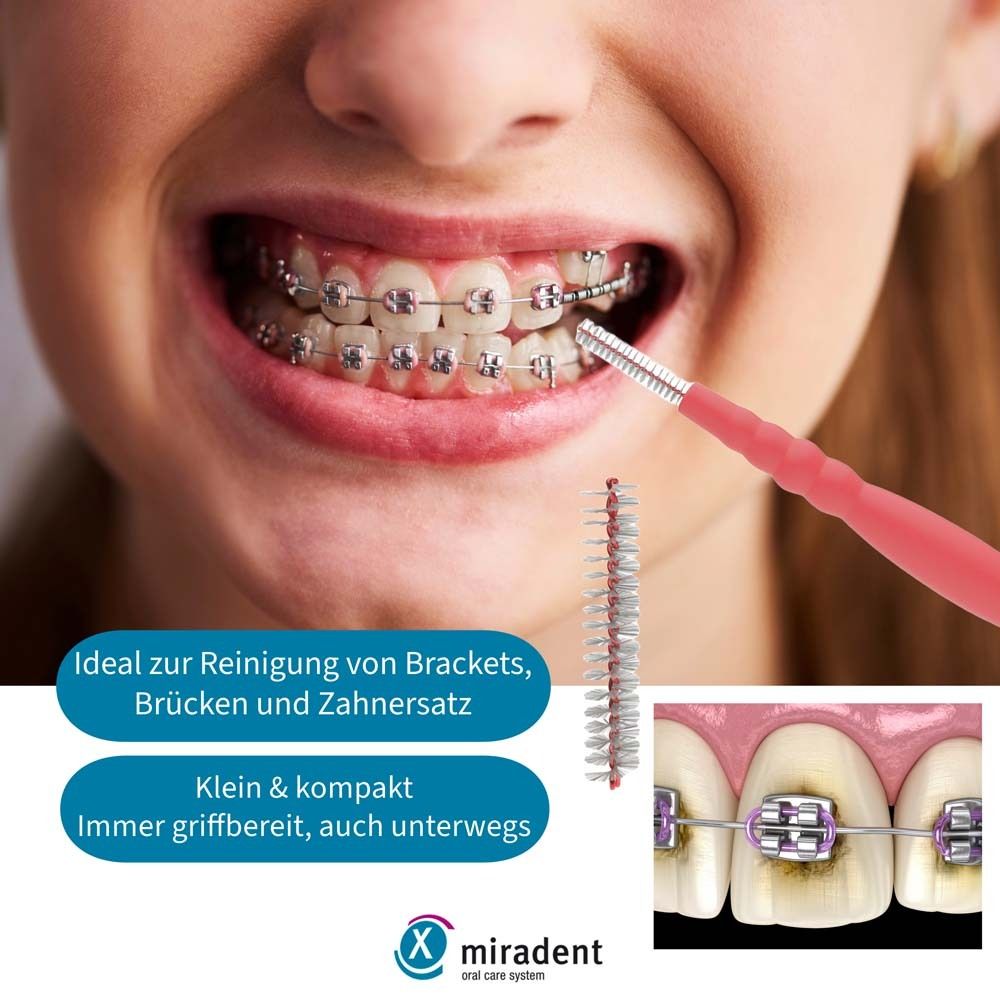 Person mit Zahnspange verwendet eine rosa Interdentalbürste. Nahaufnahme von Zähnen mit Zahnspange. Miradent Logo.