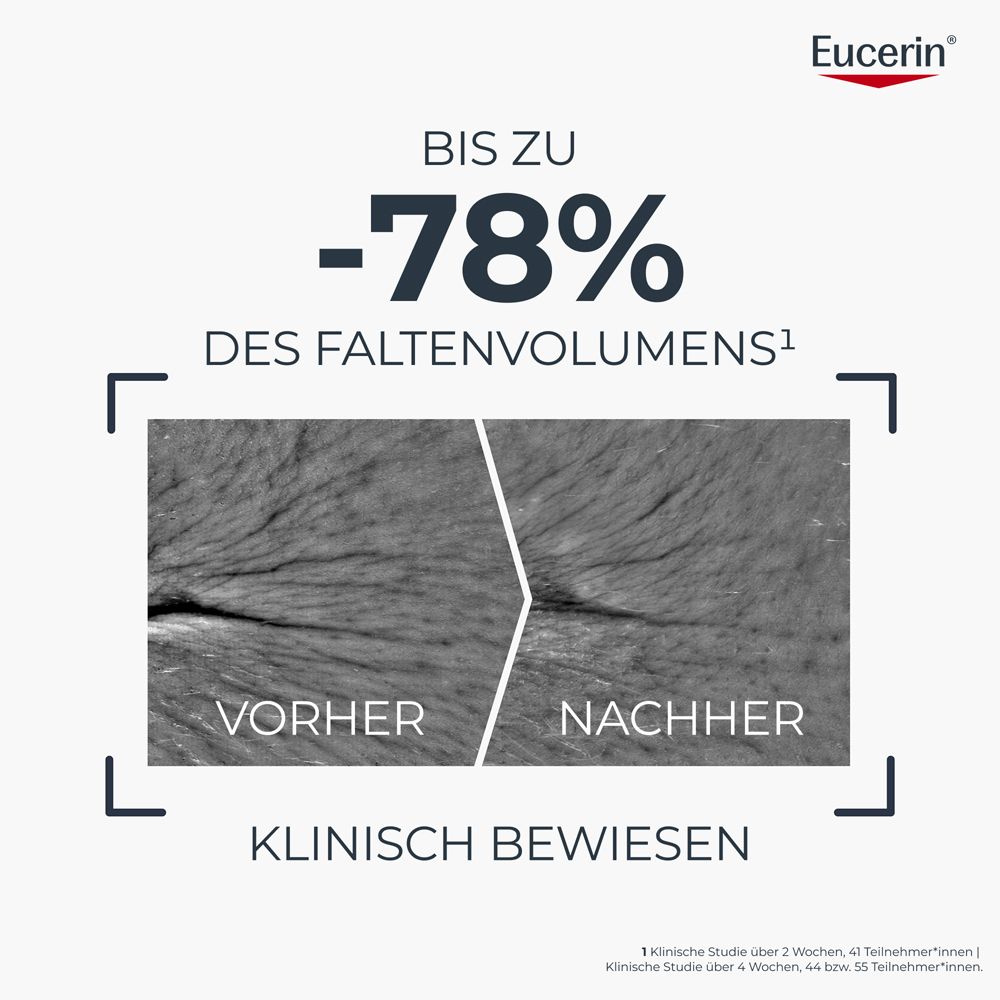Klinisch bewiesen: Vorher/Nachher-Vergleich von Hautfalten mit Reduzierung um 78%.