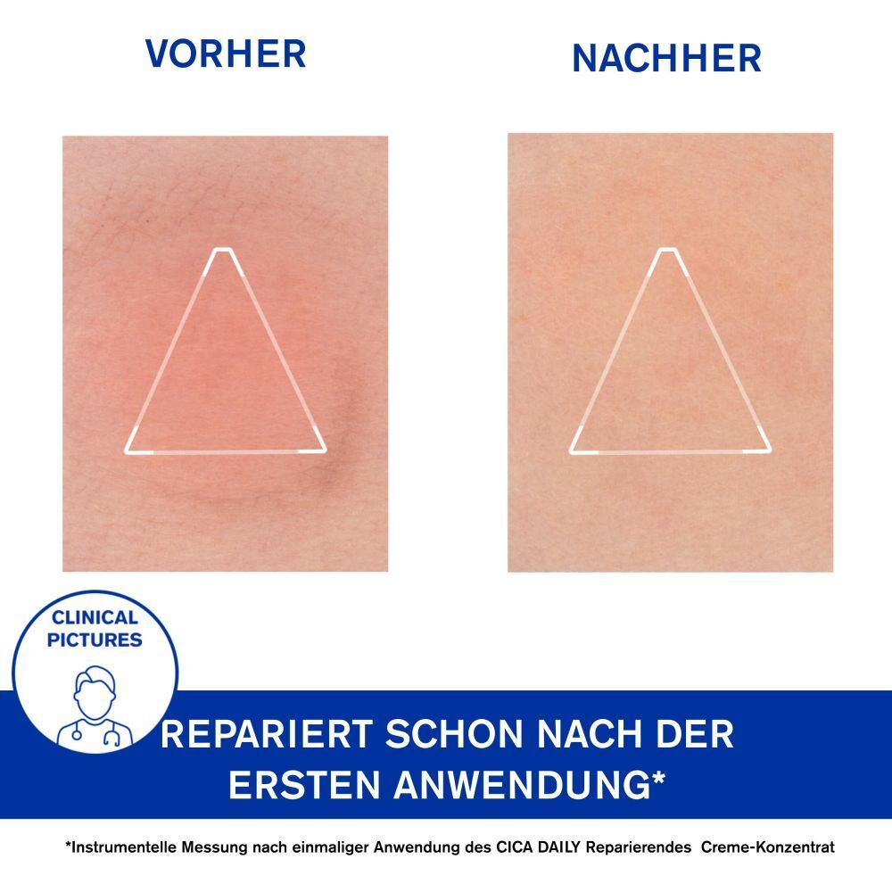 BARIÉDERM - CICA DAILY GEL-CREME