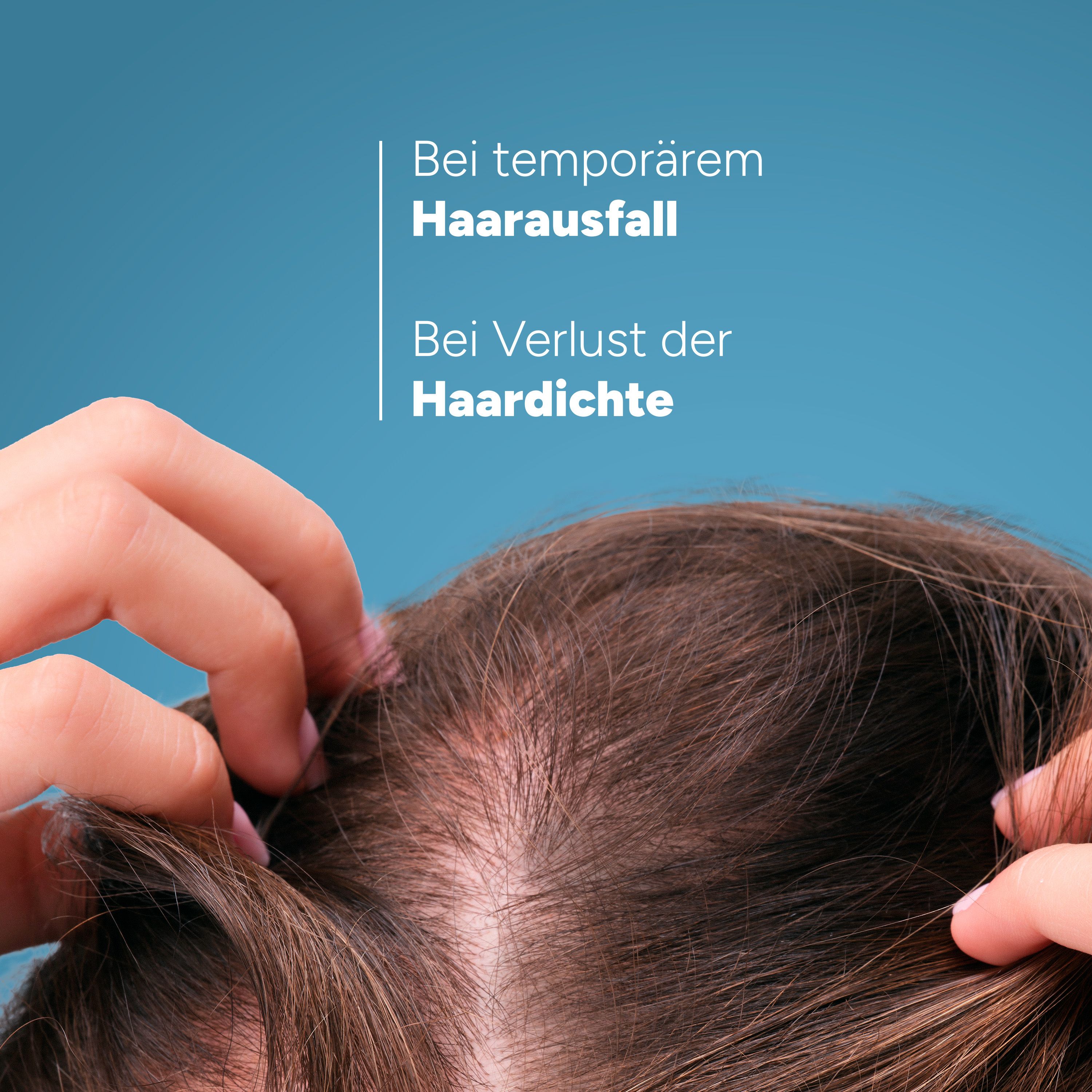 Mains sur le cuir chevelu avec perte de cheveux. Texte: Pour chute de cheveux temporaire, Pour perte de densité capillaire.