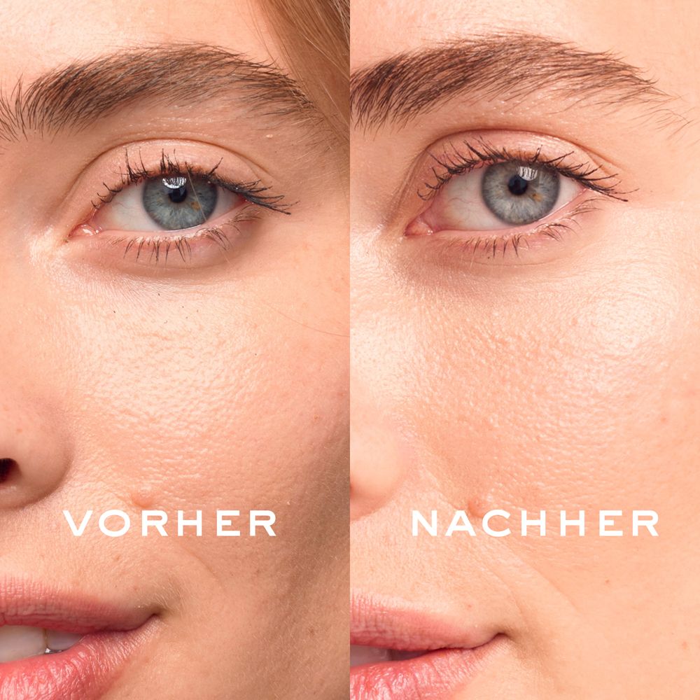 Vorher-Nachher-Vergleich. Augenpartie. Links: Vorher. Rechts: Nachher. Haut wirkt ebenmäßiger.