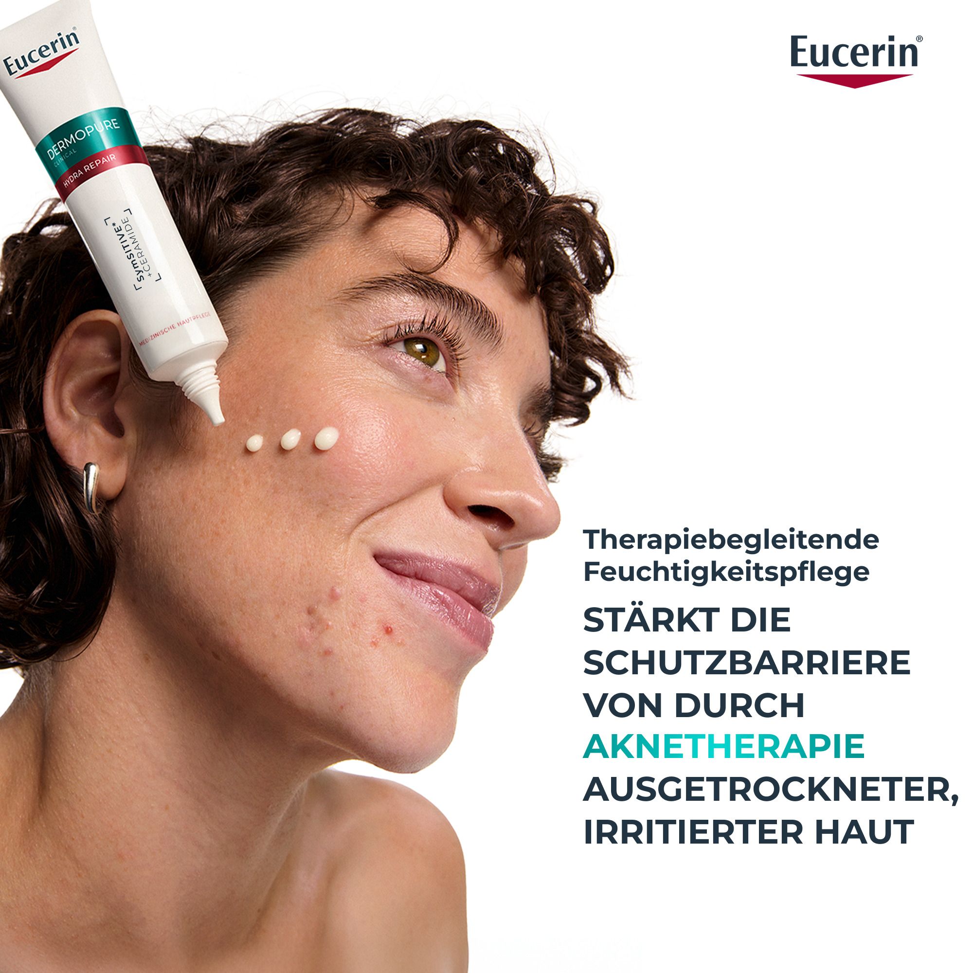Frau trägt Creme auf. Text: Therapiebegleitende Feuchtigkeitspflege. Stärkt die Schutzbarriere von durch Aknetherapie ausgetrockneter, irritierter Haut.