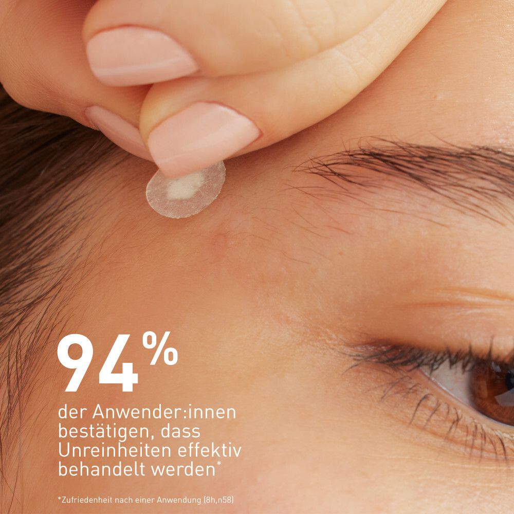 Application d'un patch sur la peau. 94% des utilisateurs confirment un traitement efficace des imperfections.