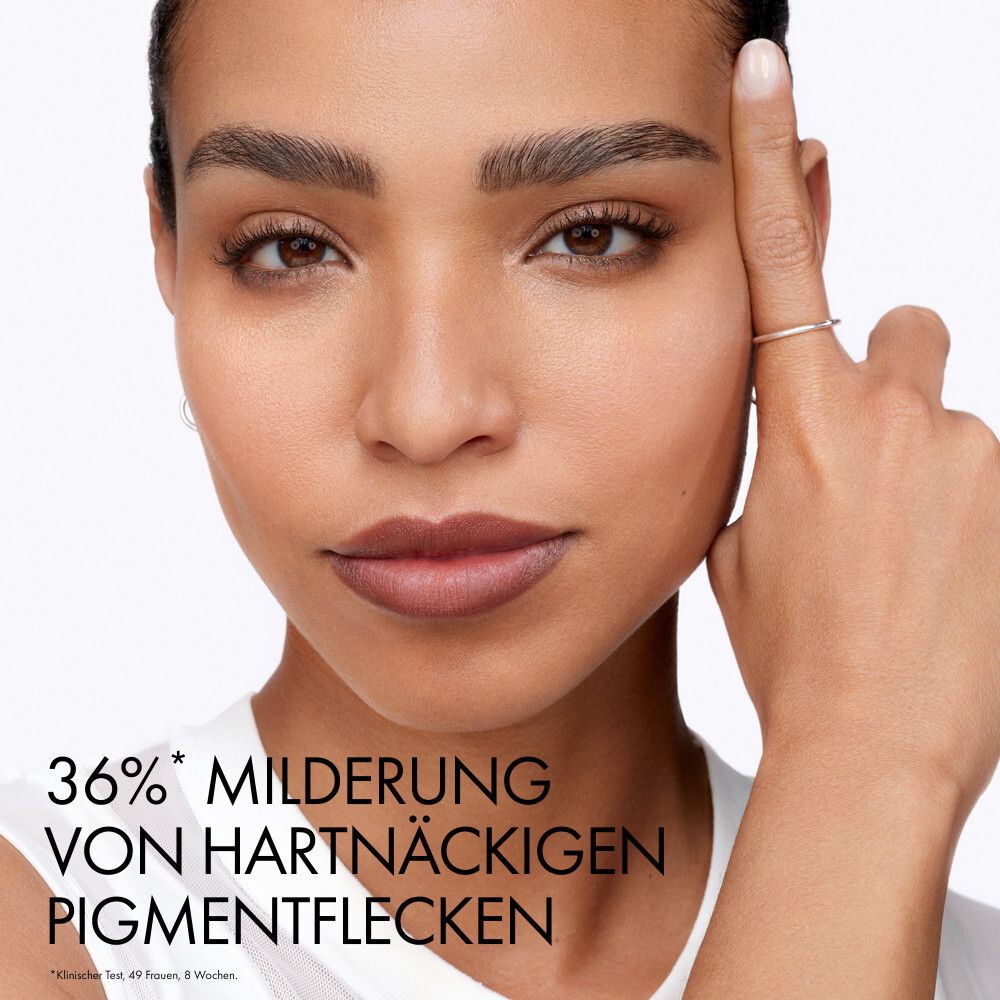 Frau mit Pigmentflecken, die sich mit dem Finger an die Stirn tippt.