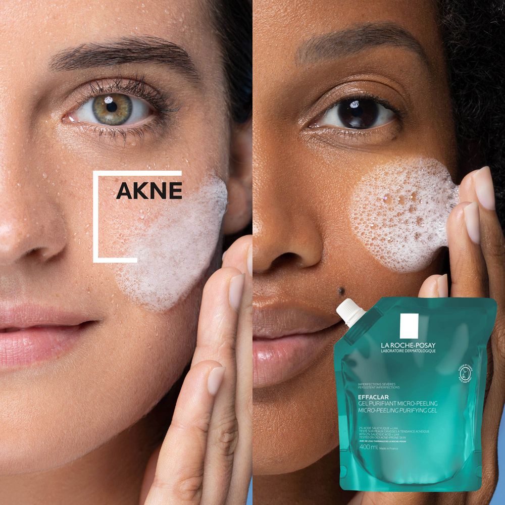 La Roche-Posay Effaclar Gel reinigt die Haut. Gegenüberstellung zweier Gesichter, eines mit Akne. Nachfüllpackung des Gels.