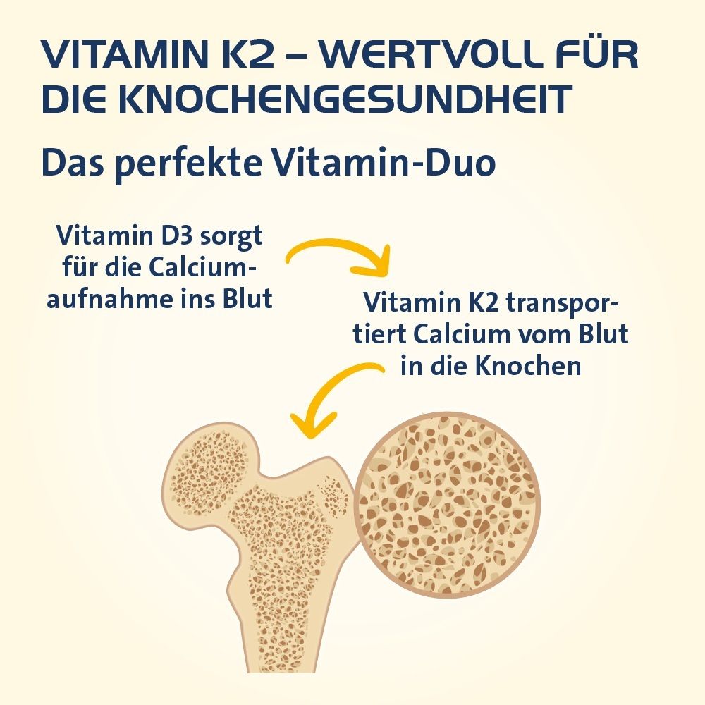Illustration einer Hüftknochenstruktur mit einer vergrößerten Ansicht, die die Knochenstruktur zeigt.