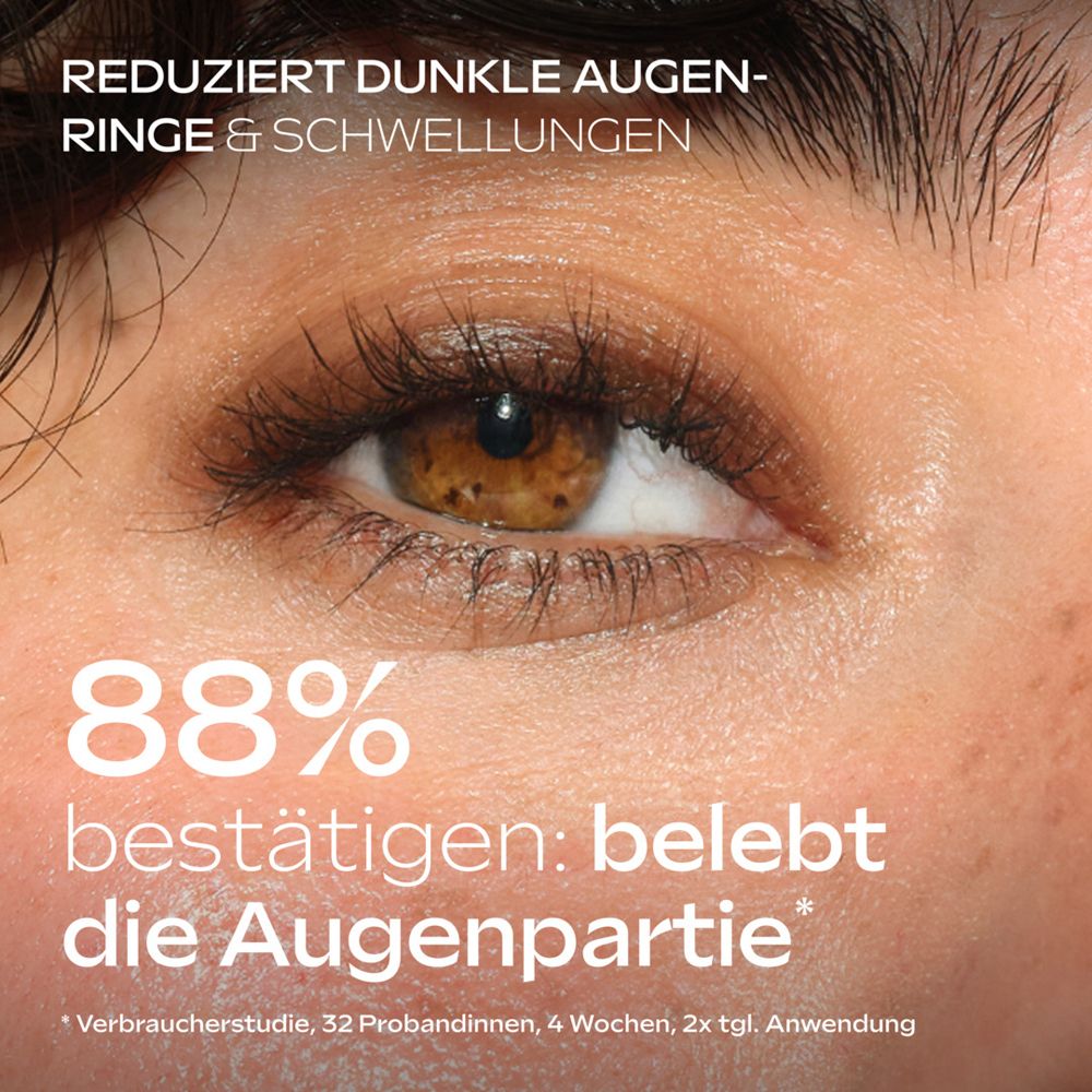 Nahaufnahme eines Auges, das dunkle Ringe und Schwellungen reduziert.
