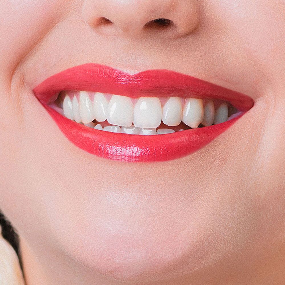 Nahaufnahme eines Lächelns mit roten Lippen. Deutlich sichtbare Zähne.