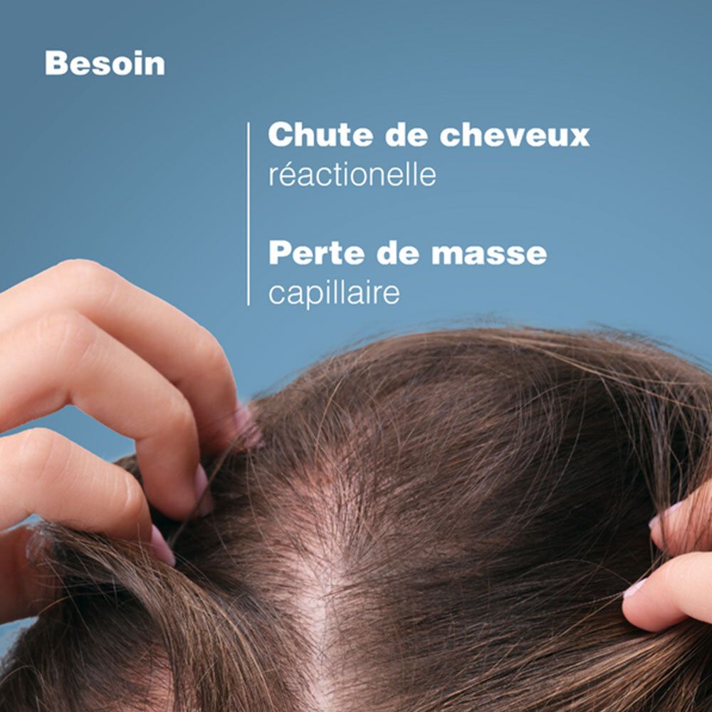Tête avec perte de cheveux. Texte : Chute de cheveux réactionnelle, Perte de masse capillaire.
