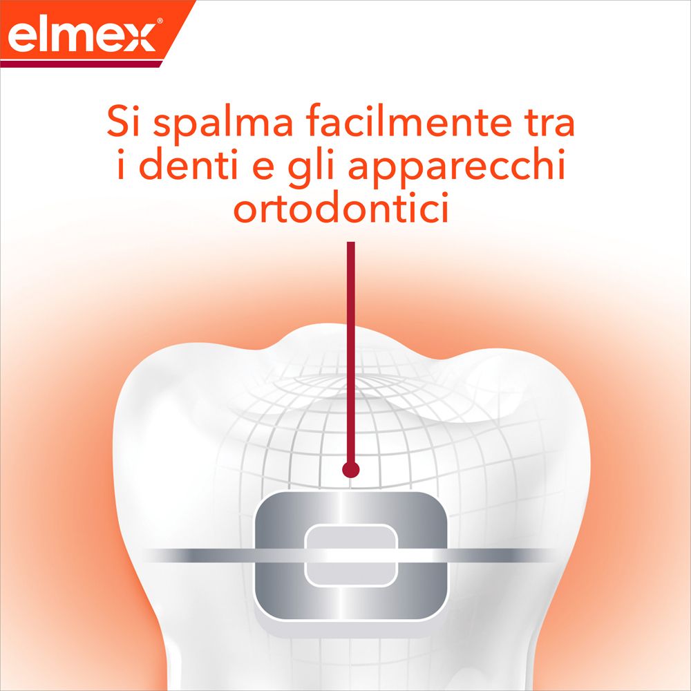 Illustration de dent avec appareil dentaire. Texte: Application facile entre les dents et les appareils orthodontiques.