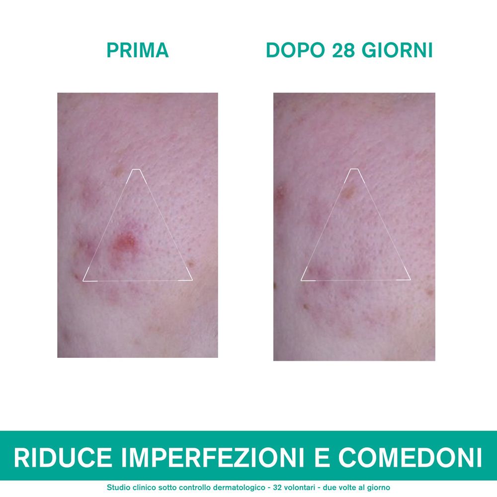 URIAGE Hyséac 3-Regul Global Treatment