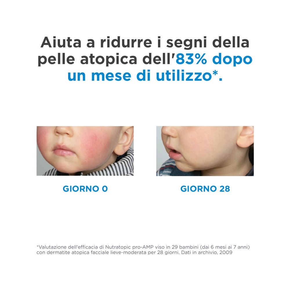 ISDIN Nutratopic® Pro-AMP-Gesichtscreme