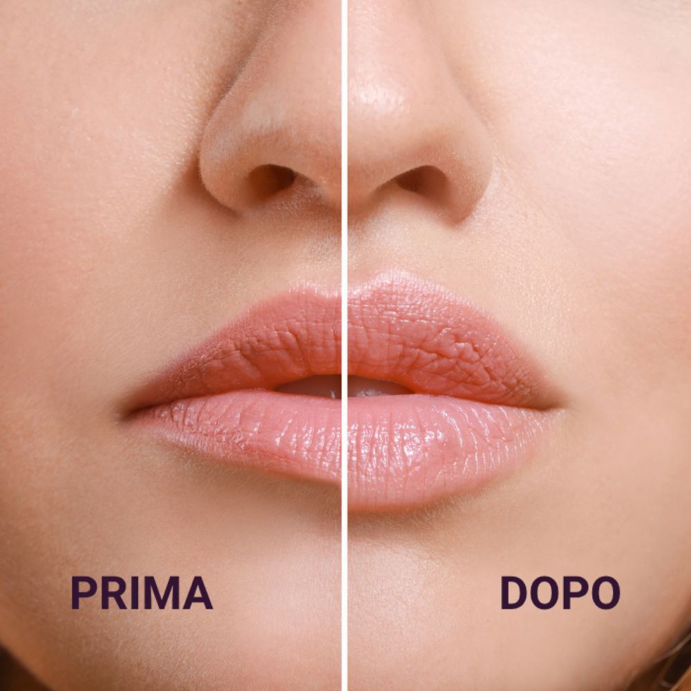 Nahaufnahme von Lippen. Links: Vorher. Rechts: Nachher. Beschriftung PRIMA und DOPO.