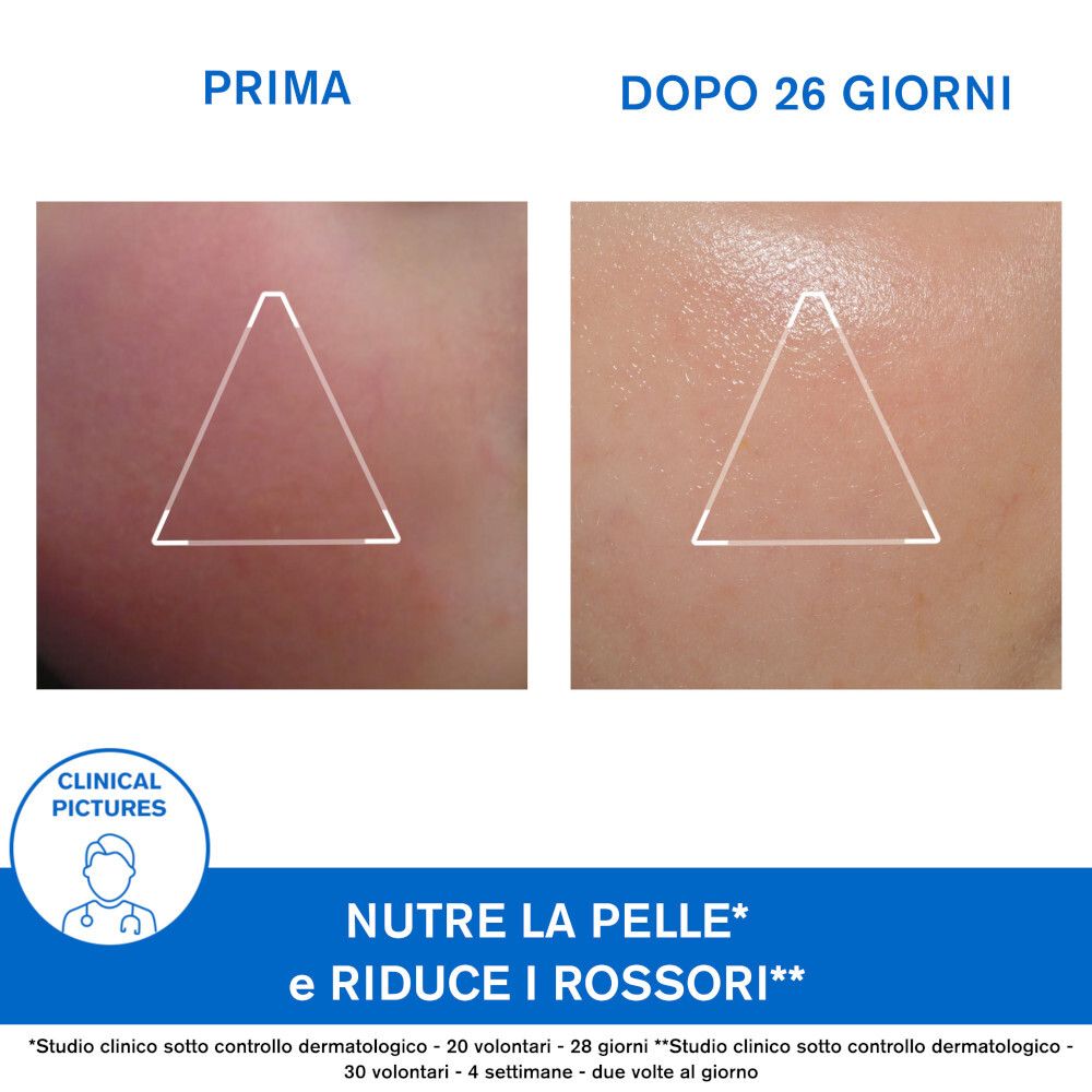 Uriage Xémose Crème Visage