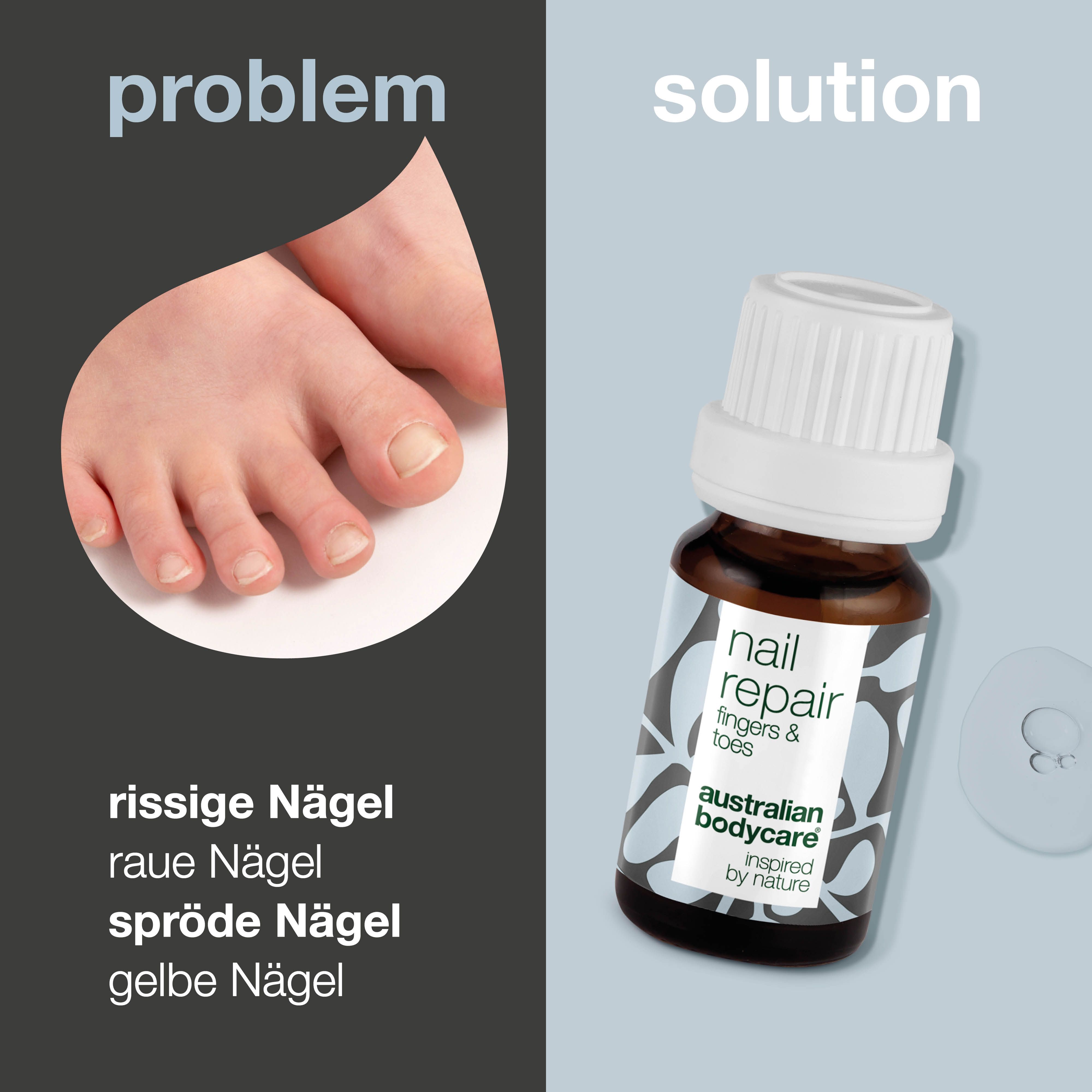 Flasche. Aufschrift: nail repair fingers & toes. Marke: Australian Bodycare. Text über Vorteile.
