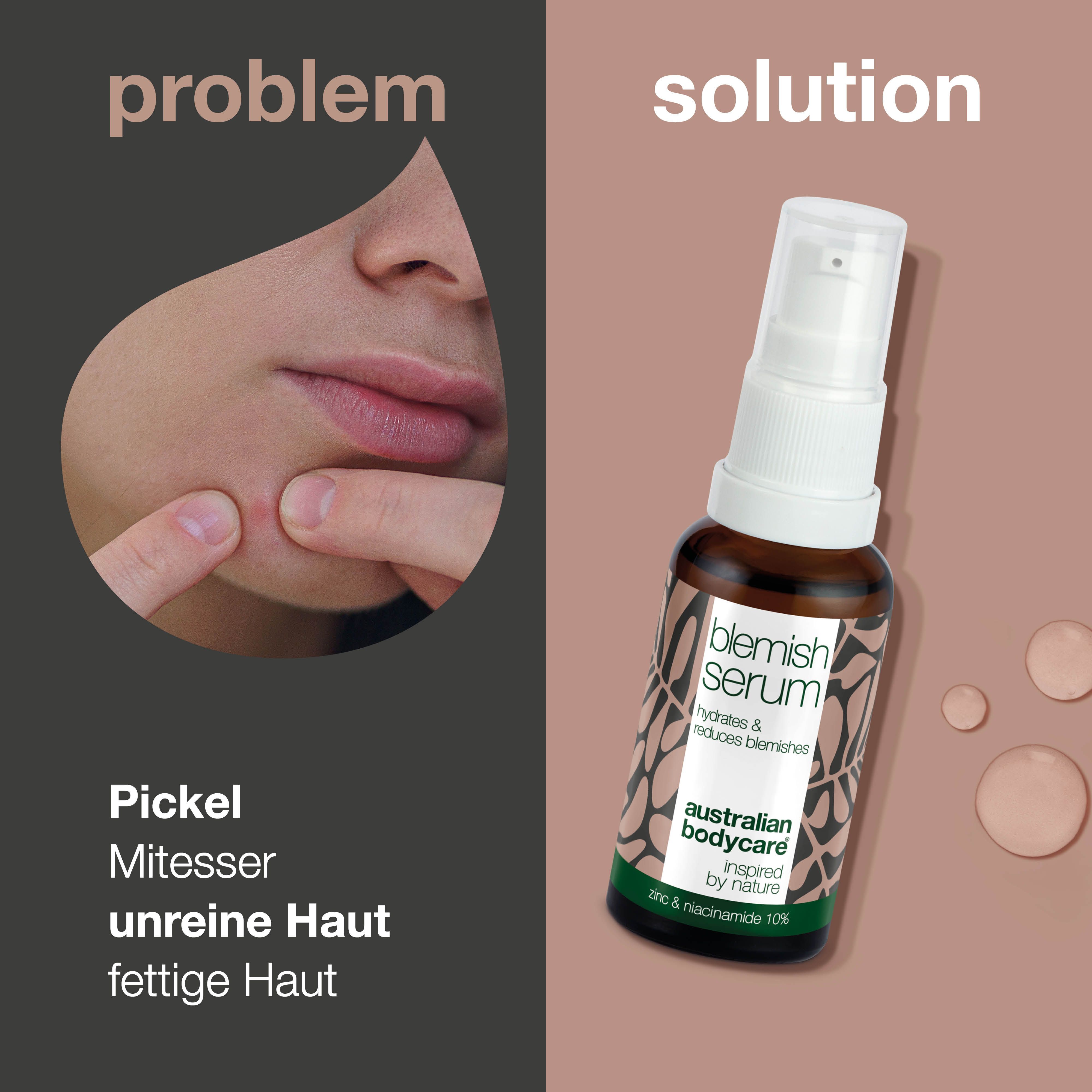 Flasche Blemish Serum mit Text. Aufschrift: Blemish Serum, hydratisiert & reduziert Unreinheiten. Marke: Australian Bodycare.
