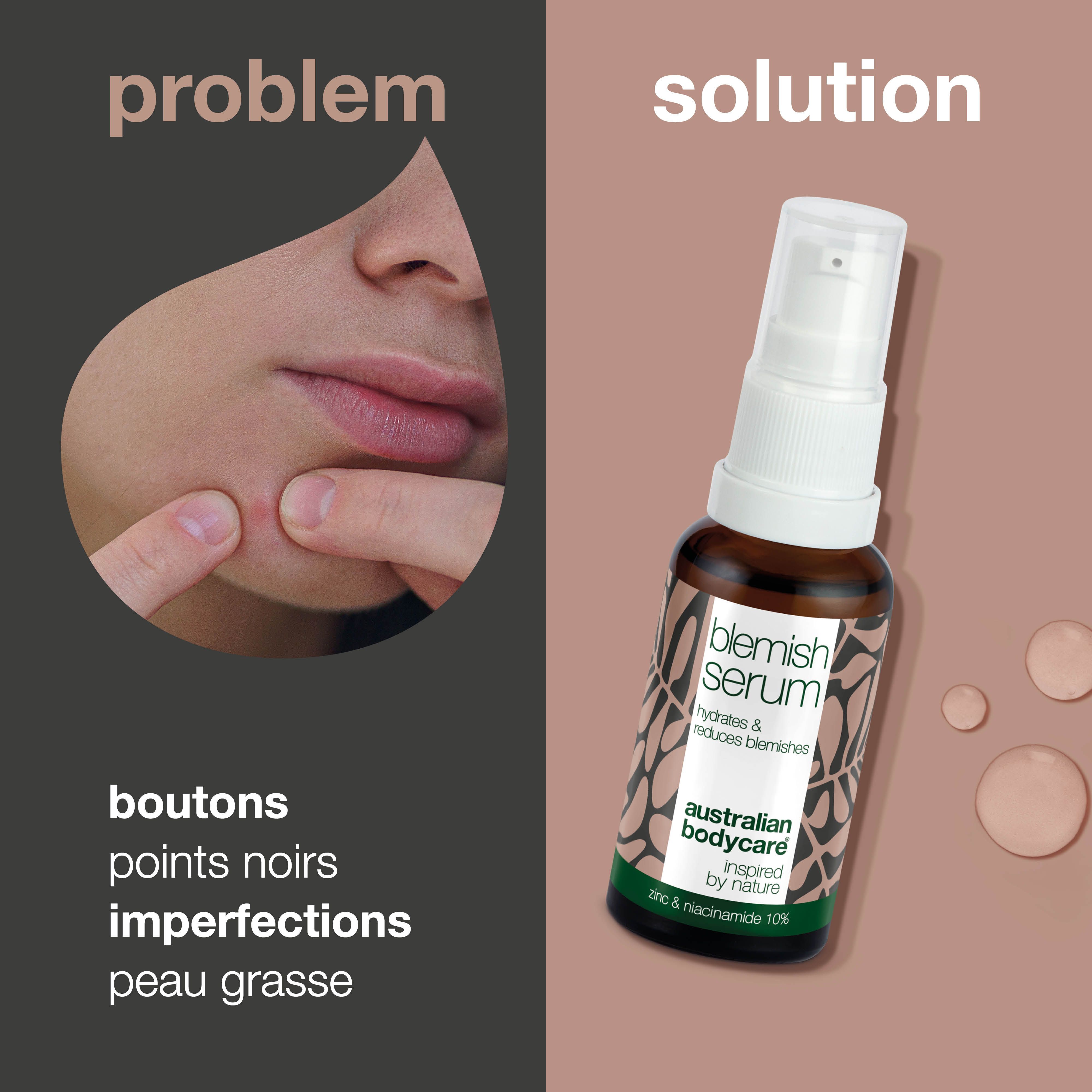 Image montrant problème et solution. Gauche : imperfections cutanées. Droite : flacon de Blemish Serum. Marque : Australian Bodycare.