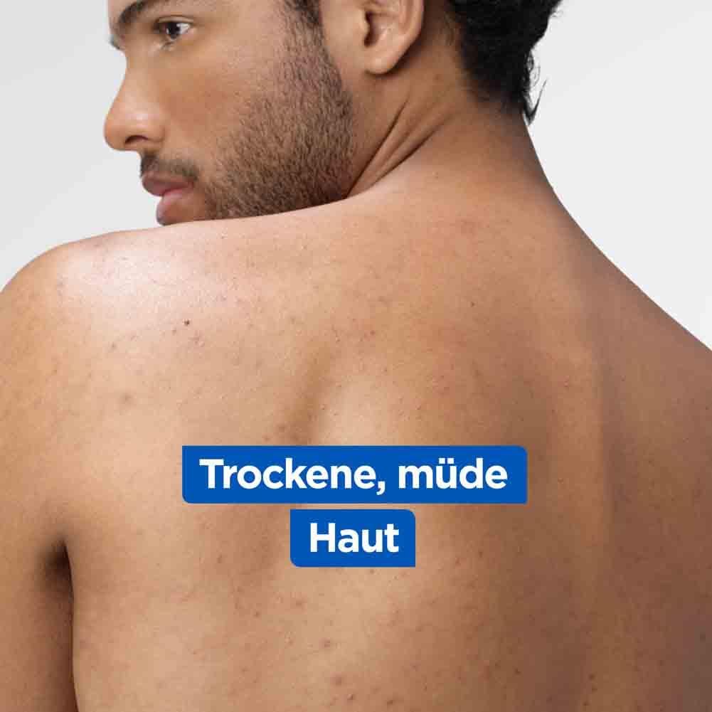 Rücken einer Person. Text: Trockene, müde Haut.