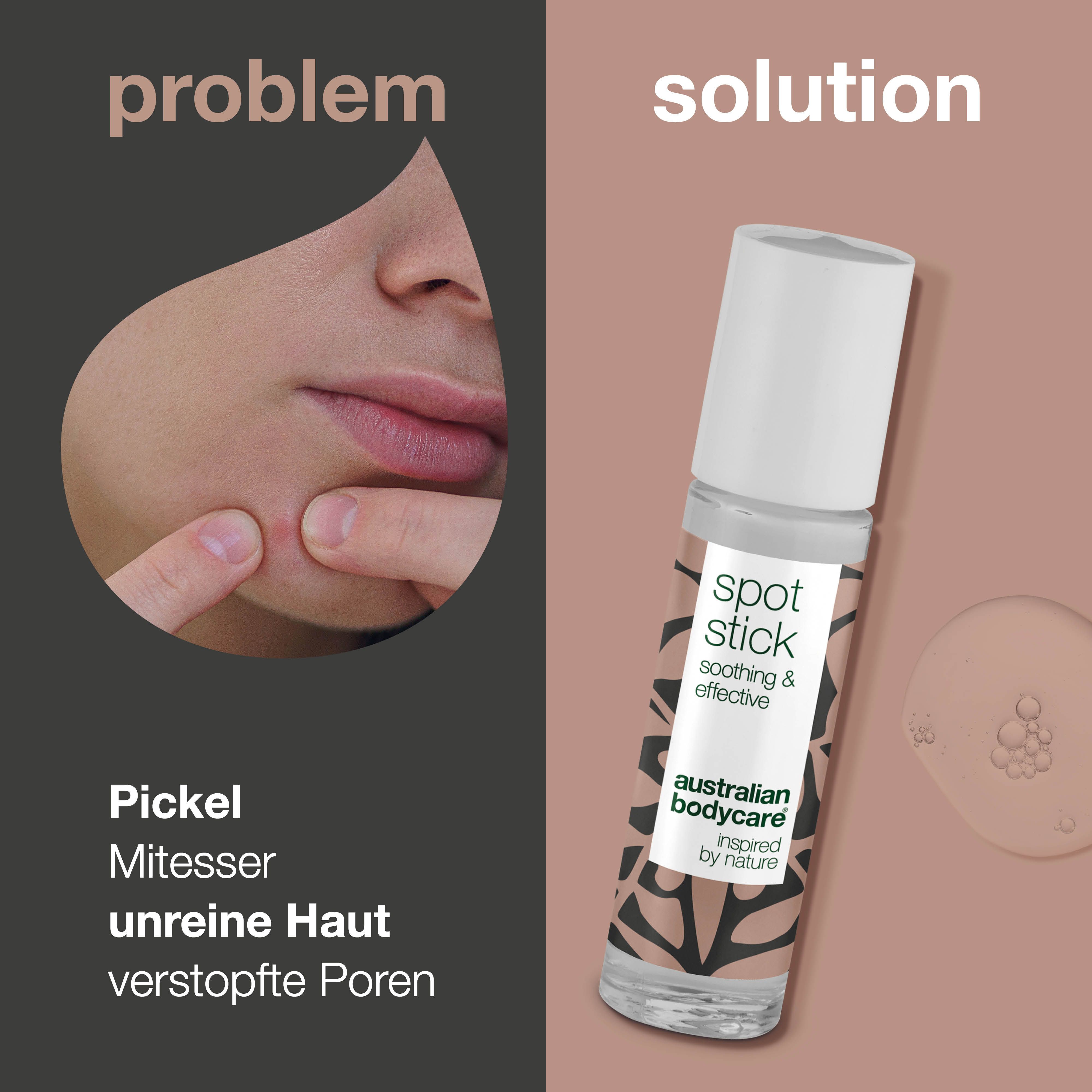 Gesicht mit Pickeln, daneben Roll-on-Stift. Aufschrift: Spot Stick, Australian Bodycare.